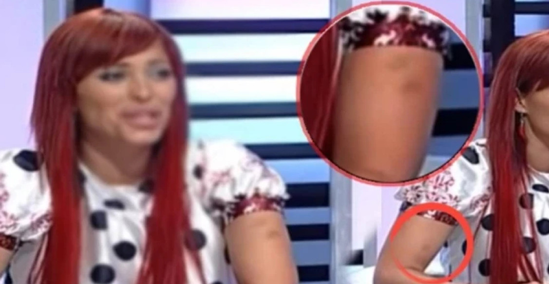 SNIMAK KOJI JE OTVORIO BROJNA PITANJA Ksenija Pajčin se u jednom od poslednjih gostovanja pojavila sa modricama na rukama